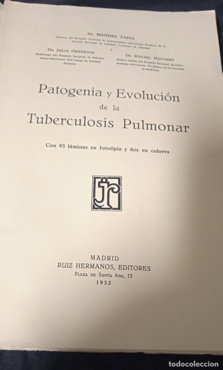 Libros de segunda mano: Tuberculosis pulmonar - Dr Manuel Tapia. - Foto 3