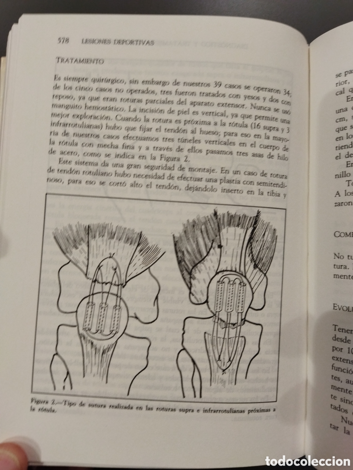 Libros de segunda mano: Lesiones deportivas Mapfre - Foto 5
