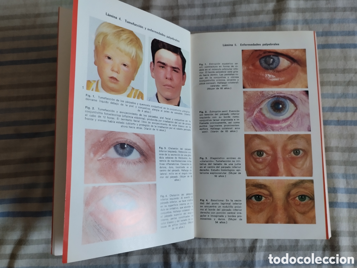 Libros de segunda mano: &rdquo;Oftalmolog&iacute;a&rdquo;.Fritz Hollwich. - Foto 4