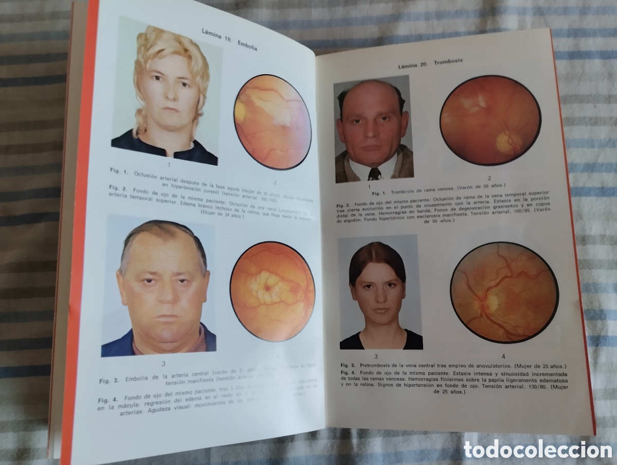Libros de segunda mano: &rdquo;Oftalmolog&iacute;a&rdquo;.Fritz Hollwich. - Foto 5