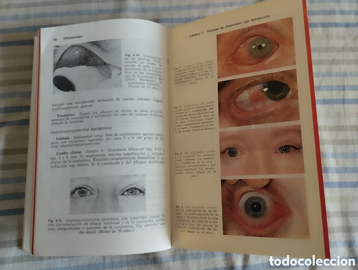 Libros de segunda mano: &rdquo;Oftalmolog&iacute;a&rdquo;.Fritz Hollwich. - Foto 6