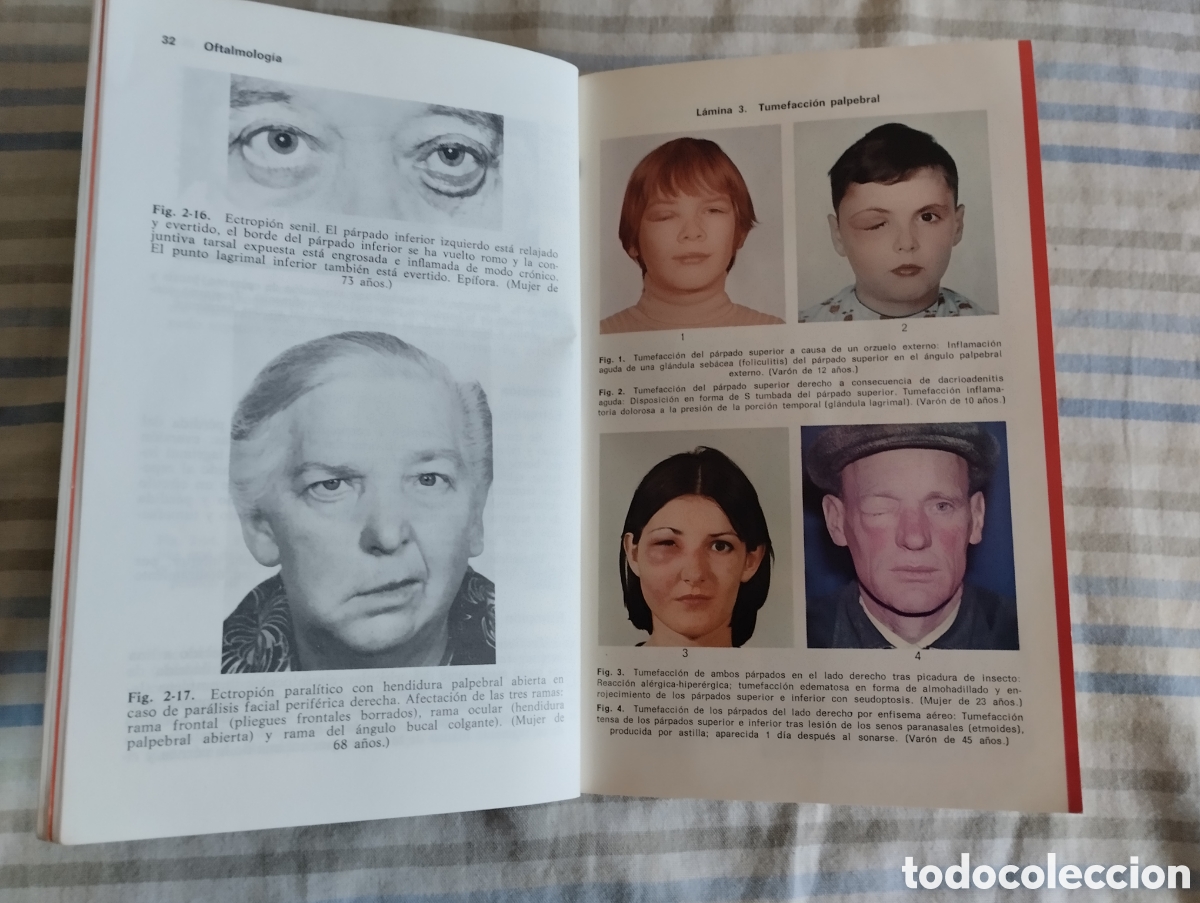 Libros de segunda mano: &rdquo;Oftalmolog&iacute;a&rdquo;.Fritz Hollwich. - Foto 7