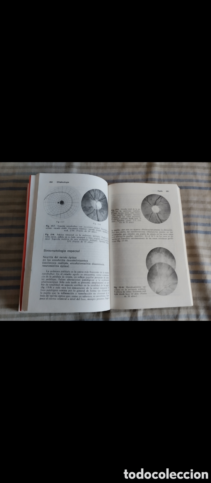 Libros de segunda mano: &rdquo;Oftalmolog&iacute;a&rdquo;.Fritz Hollwich. - Foto 8