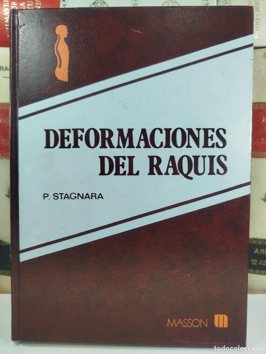 Second hand books: DEFORMACIONES DEL RAQUIS. Por P. Stagnara.