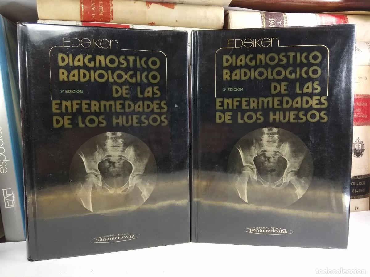 Second hand books: DIAGN&Oacute;STICO RADIOL&Oacute;GICO DE LAS ENFERMEDADES DE LOS HUESOS. EDEIKEN, Jack. Edit Panamericana, 1990