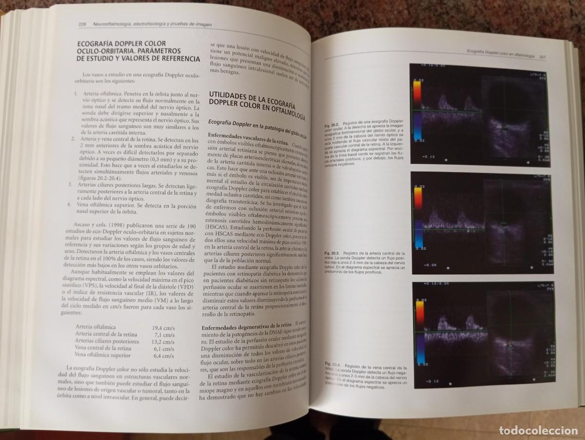 Libros de segunda mano: TECNICAS EXPLORATORIAS EN OFTALMOLOGIA - MENEZO - Foto 4