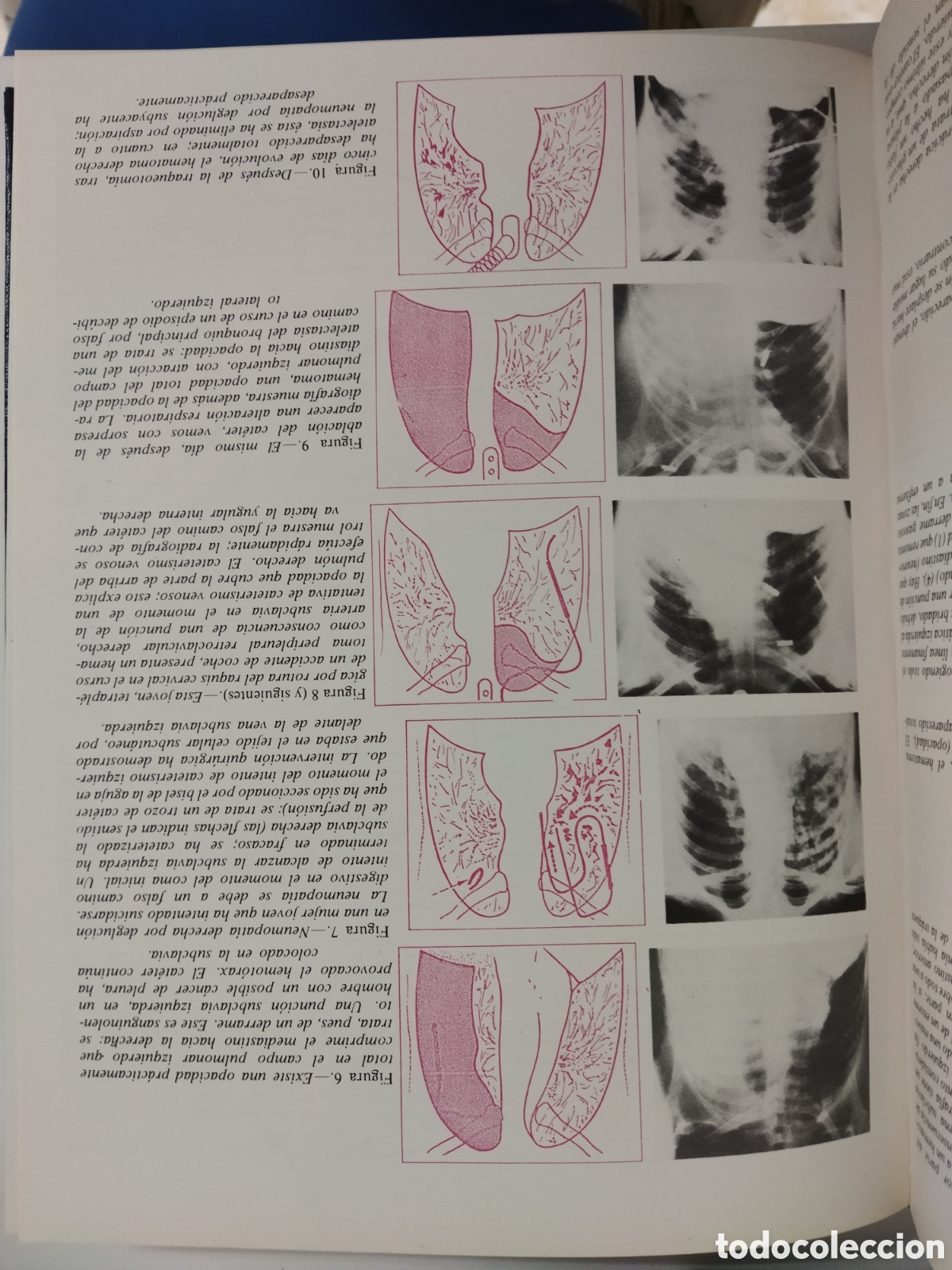 Libros de segunda mano: Enfermeria Cientifica Soins - Foto 6