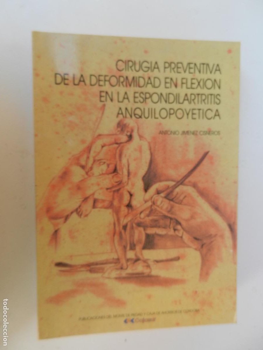 Libri di seconda mano: CIRUGIA PREVENTIVA DE LA DEFORMIDAD EN FLEXION EN LA ESPONDILARTRITIS ANQUILOPOYETICA- CAJA SUR 1991
