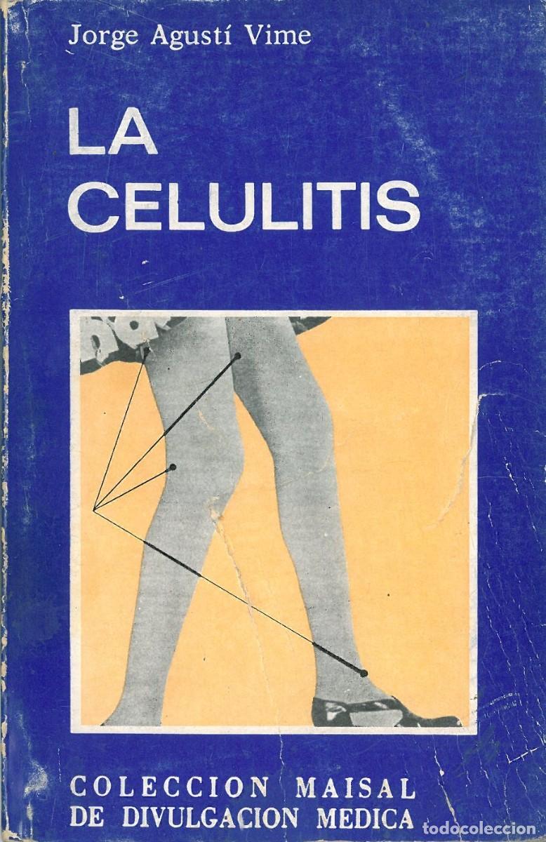 Libros de segunda mano: La Celulitis - Agusti Vime, Jorge - Foto 1
