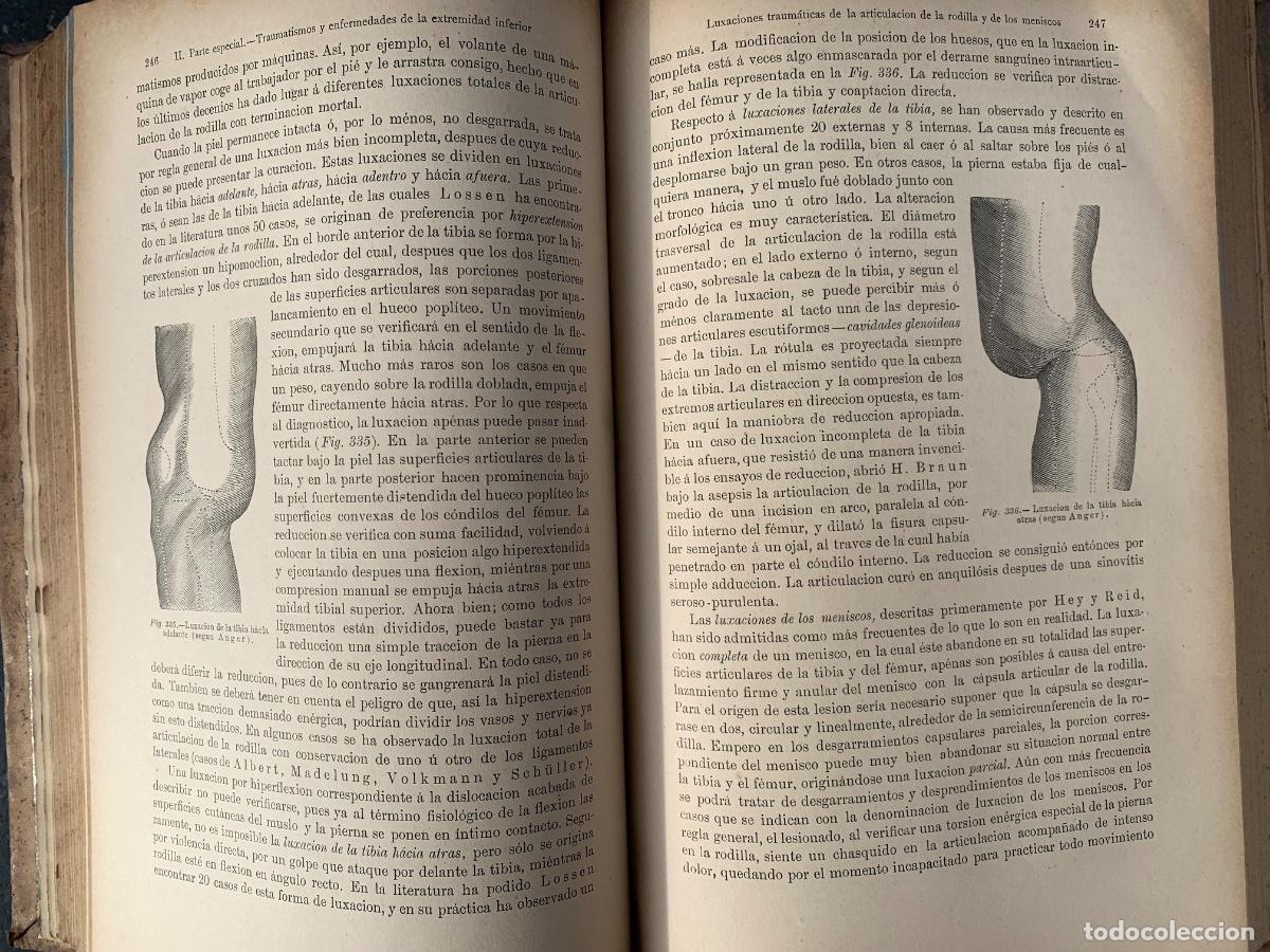 Libros de segunda mano: Elementos de Cirug&iacute;a, tres tomos - Foto 5