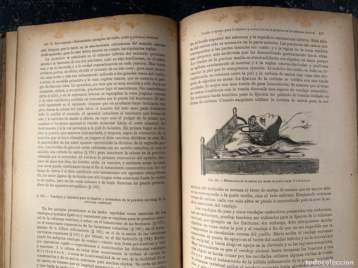 Libros de segunda mano: Elementos de Cirug&iacute;a, tres tomos - Foto 6