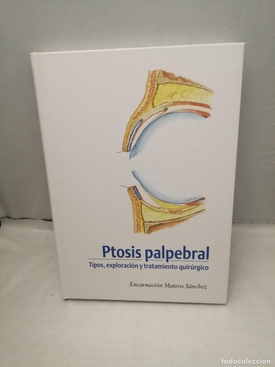 Gebrauchte B&uuml;cher: Ptosis palpebral. Tipos, exploraci&oacute;n y tratamiento quir&uacute;rgico