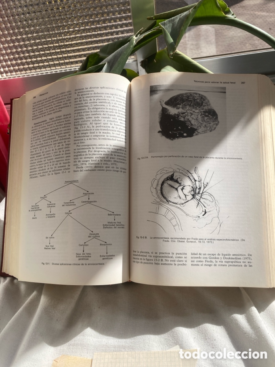 Libros de segunda mano: OBSTETRICA WILLIAMS 2 Edici&oacute;n - Foto 6