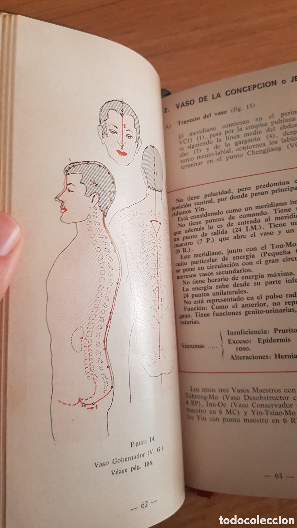 Libros de segunda mano: Abc de la acupuntura. Cabal - Foto 6