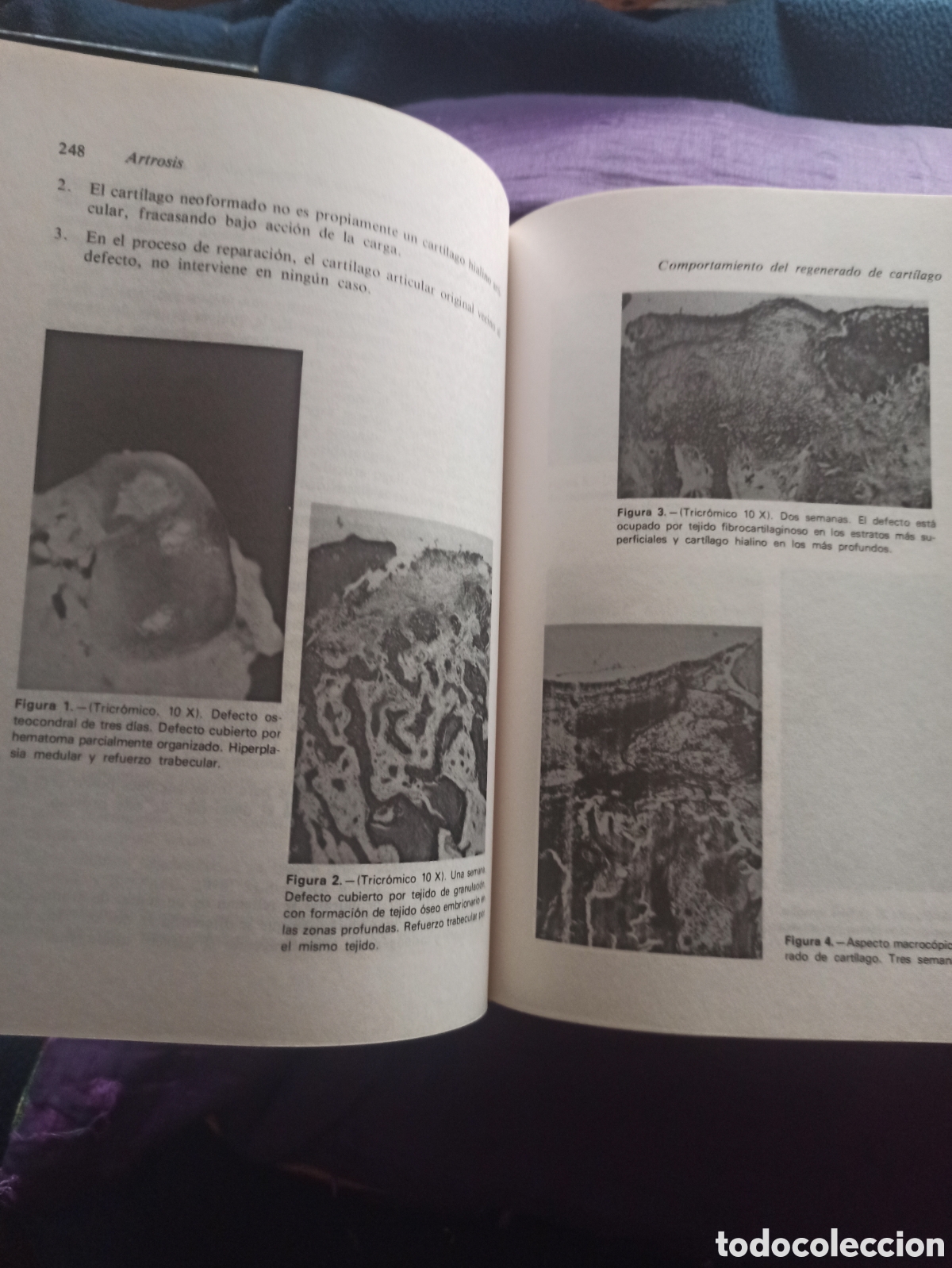 Libros de segunda mano: ARTROSIS - Fundaci&oacute;n Mapfre - Foto 2