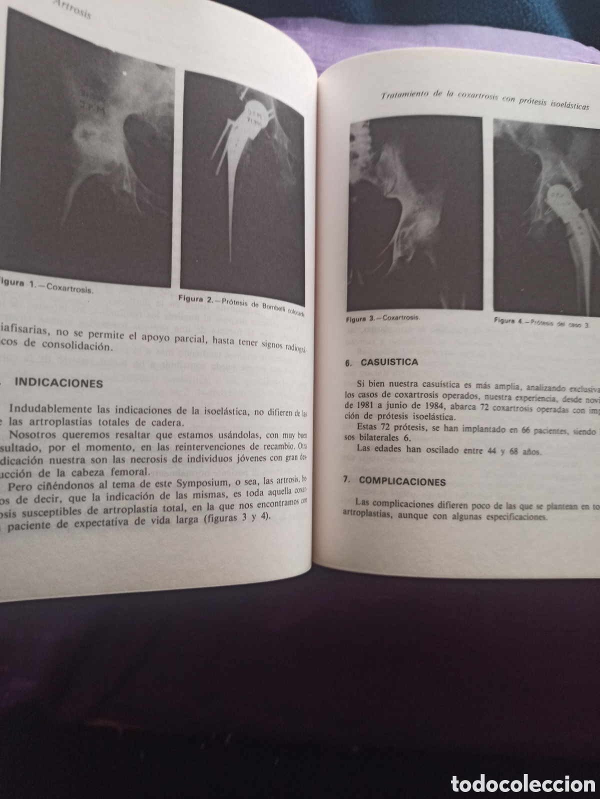 Libros de segunda mano: ARTROSIS - Fundaci&oacute;n Mapfre - Foto 4