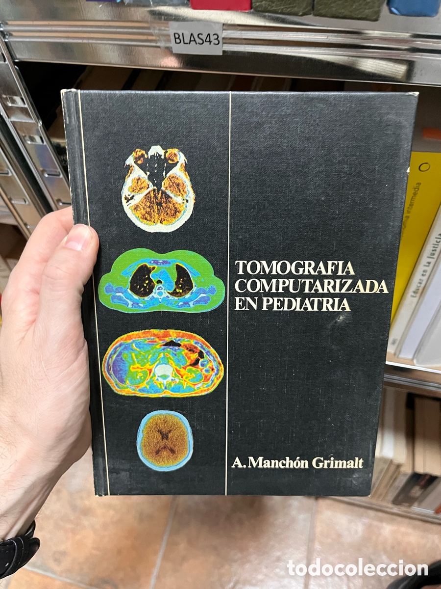 Libros de segunda mano: Blas43 TOMOGRAFIA COMPUTARIZADA EN PEDIATRIA A. Manch&oacute;n Grimalt