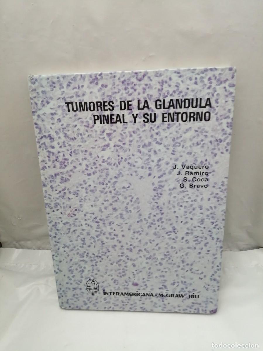 Libros de segunda mano: Tumores de la gl&aacute;ndula pineal y su entorno (INCLUYE TARJETA CON FIRMA DE Jes&uacute;s Vaquero Crespo)