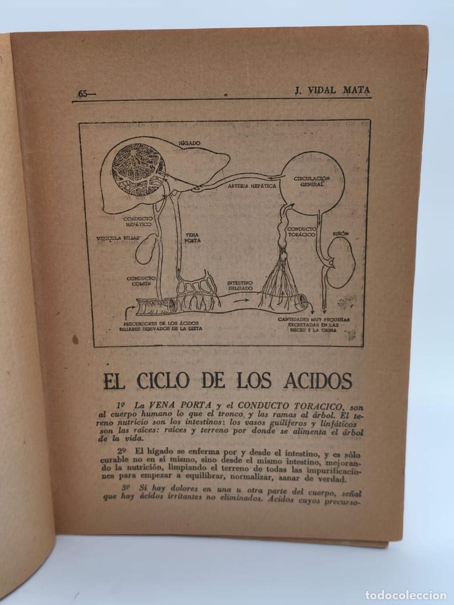 Libros de segunda mano: J. Vidal Mata &ndash; La Diabetes - Foto 2