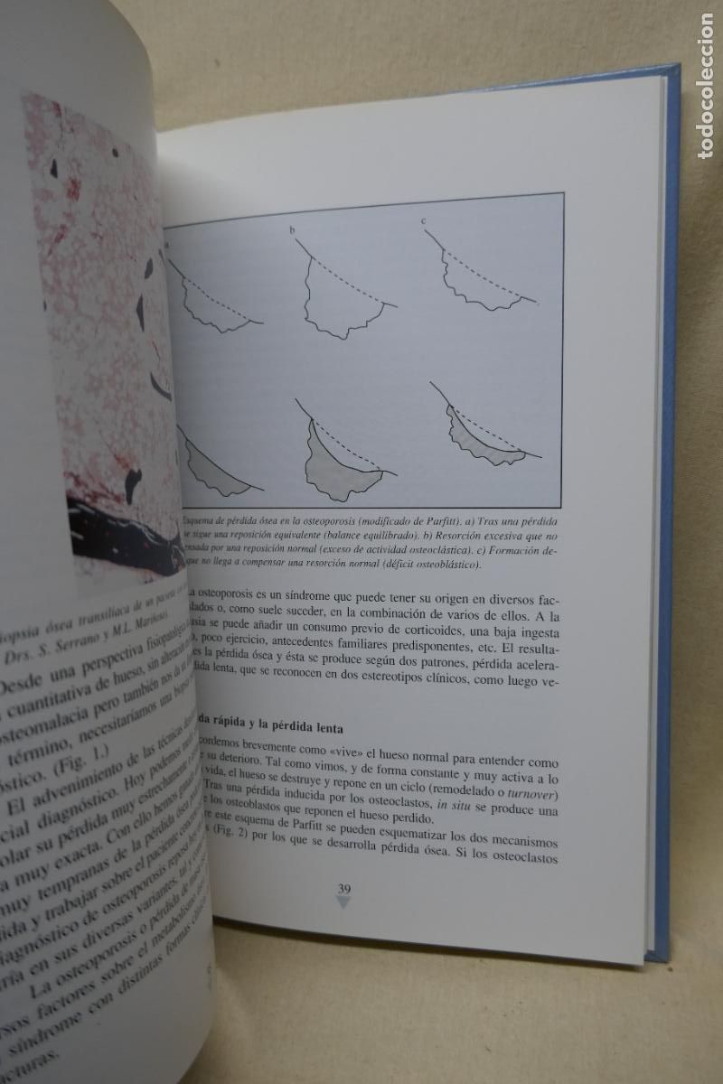 Libros de segunda mano: OSTEOPOROSIS - A DIEZ PEREZ - Foto 9