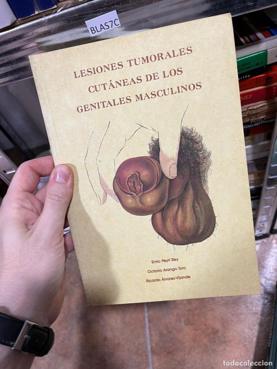 Libros de segunda mano: BLAS7C LESIONES TUMORALES CUTANEAS DE LOS GENITALES MASCULINOS, ENRIC PEYRL, OSTAVIO ARANGO, RICARDO