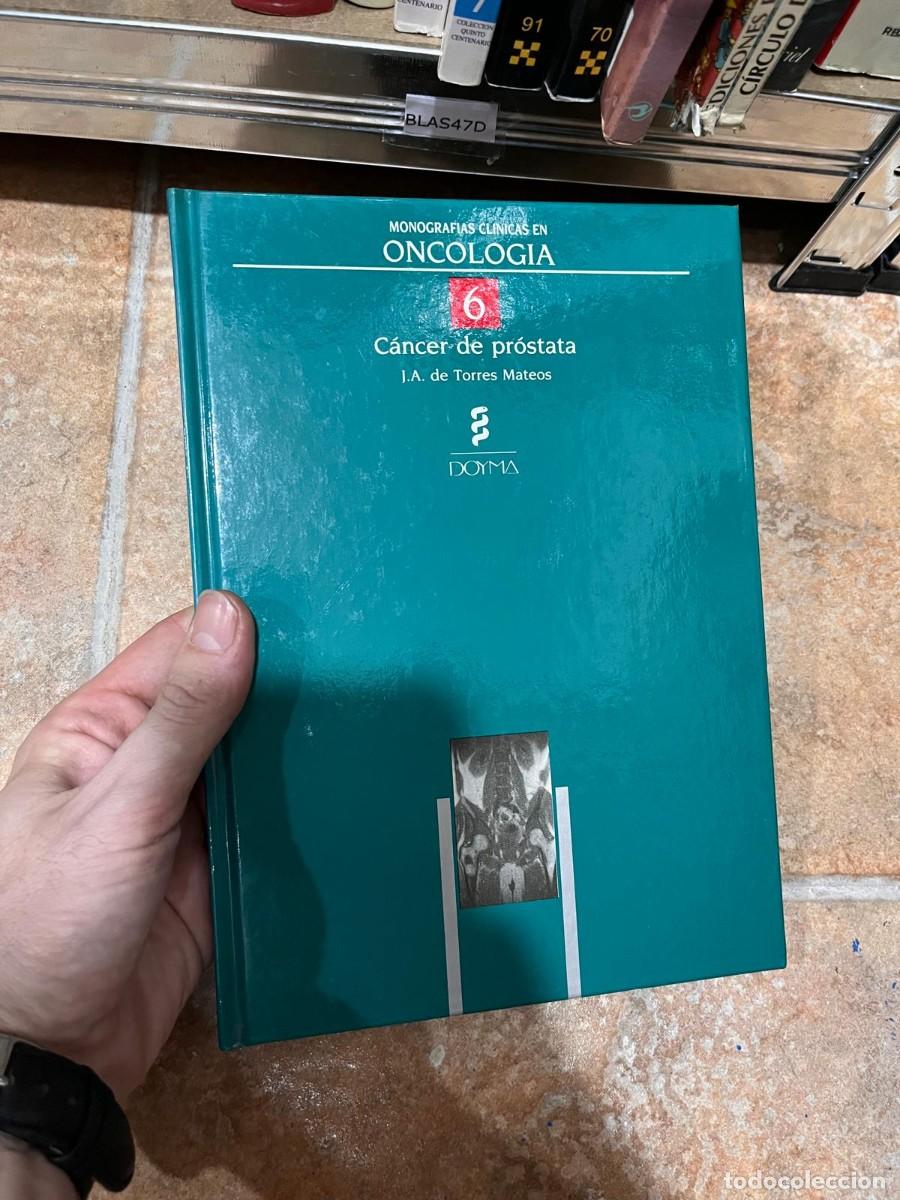 Libros de segunda mano: BLAS47D CANCER DE PROSTATA, ONCOLOGIA. TORRES MATEOS.