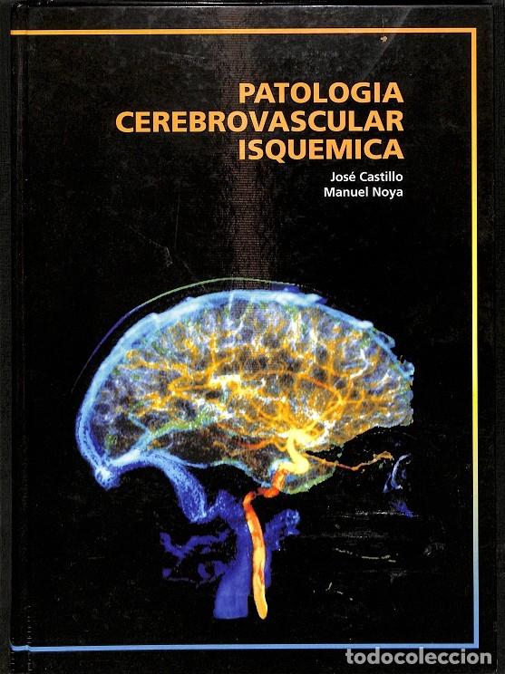 Gebrauchte B&uuml;cher: PATOLOG&Iacute;A CEREBROVASCULAR ISQU&Eacute;MICA - J. Castillo, M. Noya - Editores Varios - 1993