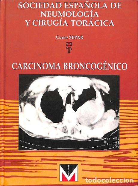 Second hand books: CARCINOMA BRONCOG&Eacute;NICO - SOCIEDAD ESPA&Ntilde;OLA DE APARATO RESPIRATORIO - MENARINI - 1993