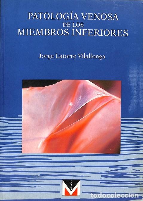 Second hand books: PATOLOGIA VENOSA MIEMBROS INFERIORES - JORGE LATORRE VILLALONGA - MENARINI - 1995