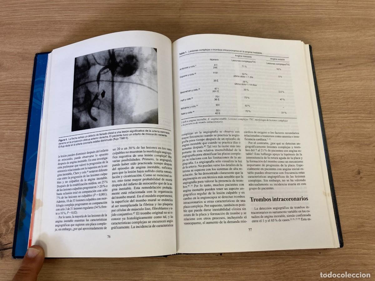 Libros de segunda mano: S&iacute;ndromes de Aterosclerosis Valent&iacute;n Fuster - Foto 5