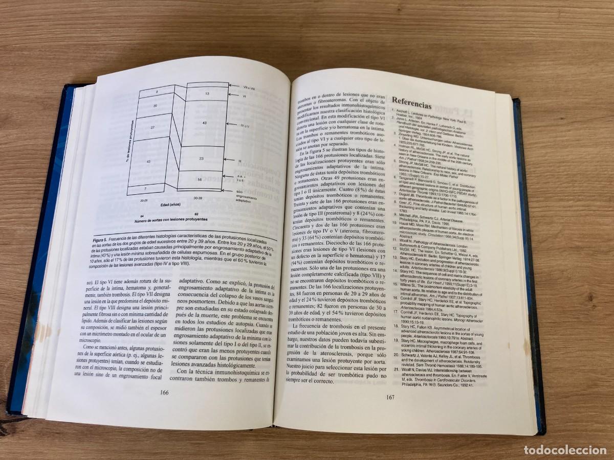 Libros de segunda mano: S&iacute;ndromes de Aterosclerosis Valent&iacute;n Fuster - Foto 6