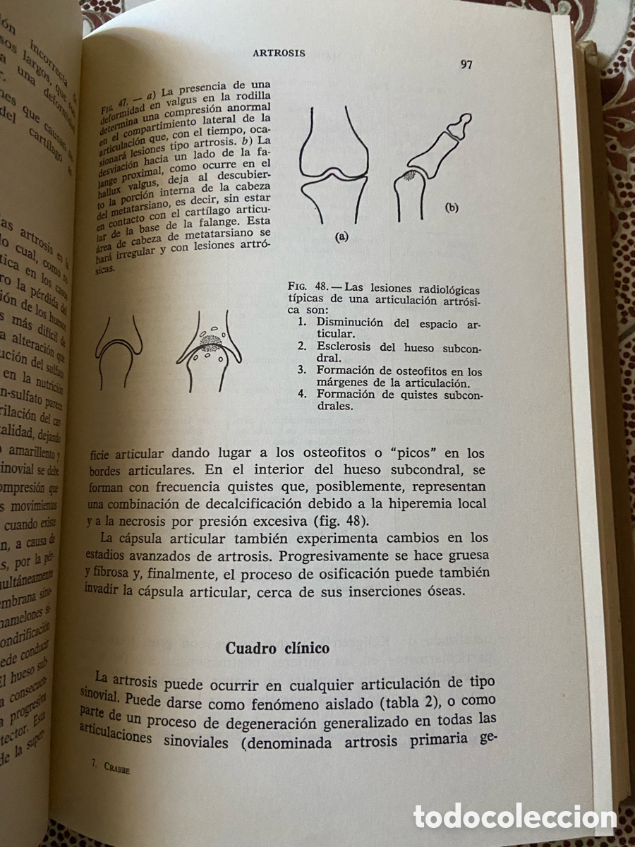 Libros de segunda mano: Manual de Ortopedia de W. A. Crabbe - Foto 4