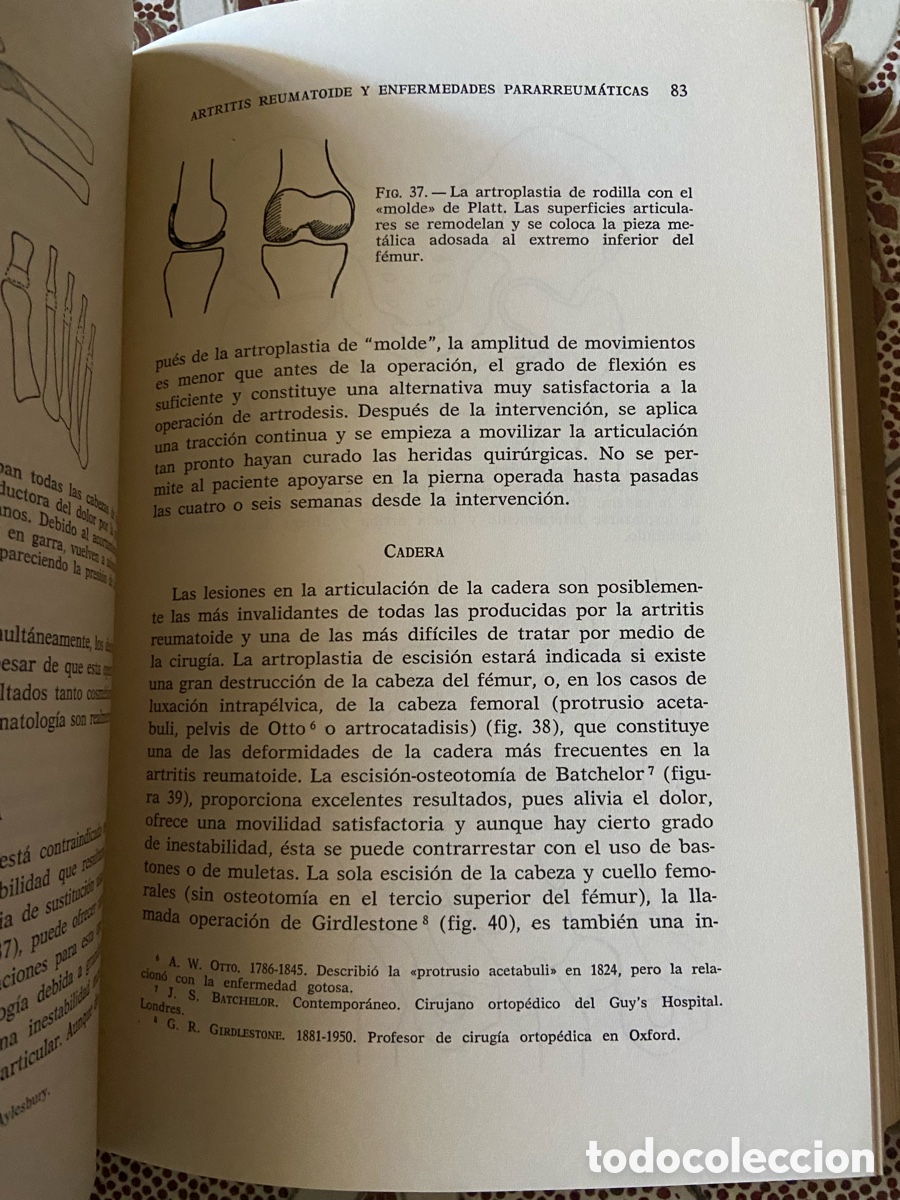 Libros de segunda mano: Manual de Ortopedia de W. A. Crabbe - Foto 5