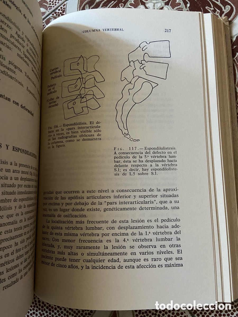 Libros de segunda mano: Manual de Ortopedia de W. A. Crabbe - Foto 6