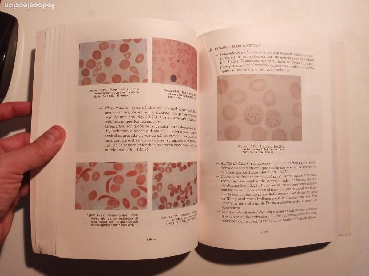 Libros de segunda mano: PR&Aacute;CTICAS DE HEMATOLOG&Iacute;A - S. SIMEON / E. COLLADO - ECIR 1994 - Foto 6