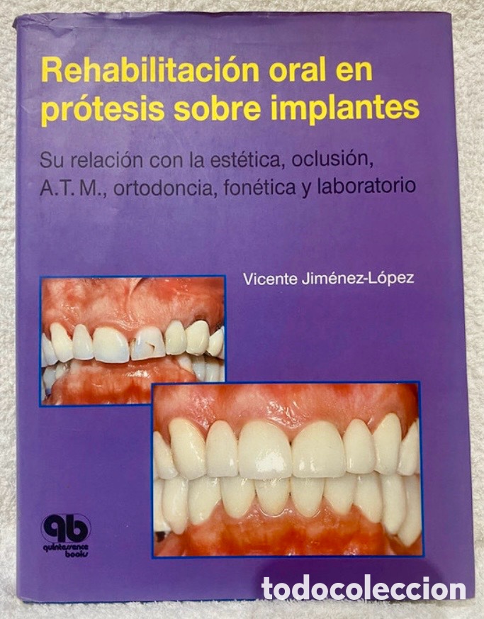Libri di seconda mano: Rehabilitaci&oacute;n oral en pr&oacute;tesis sobre implantes.