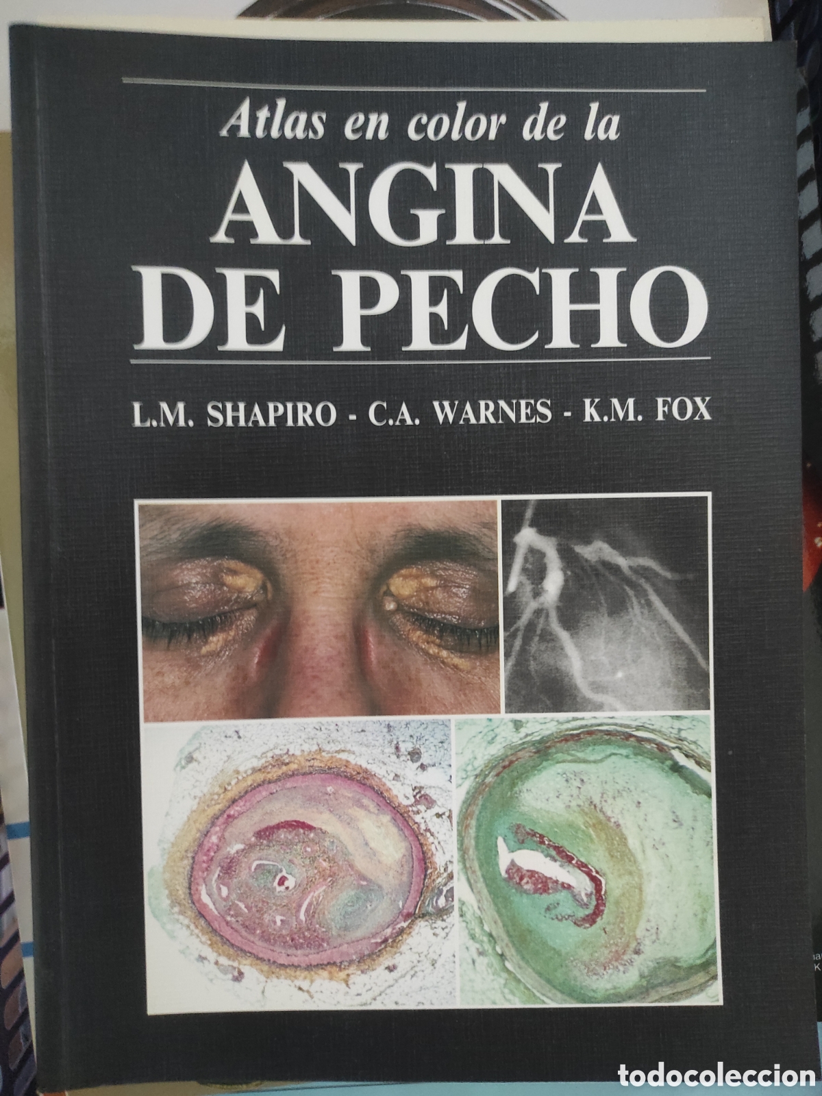 Libros de segunda mano: ATLAS EN COLOR DE LA ANGINA DE PECHO. L.M. SHAPIRO - C.A. WARNES - K.M. FOX. WOLFE. 1987