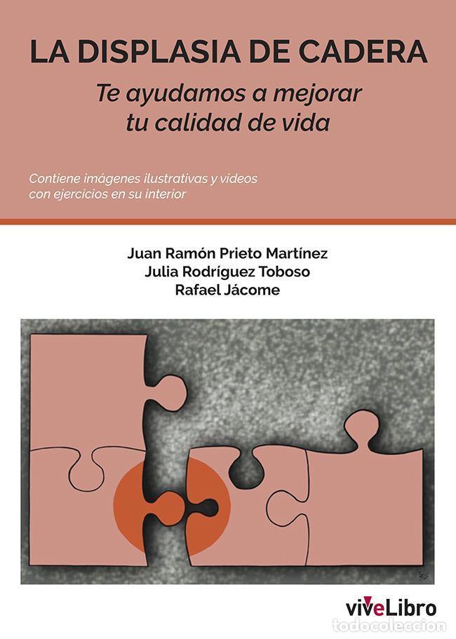 Libros de segunda mano: La displasia de cadera. - Prieto Mart&iacute;nez, Juan Ram&oacute;n.