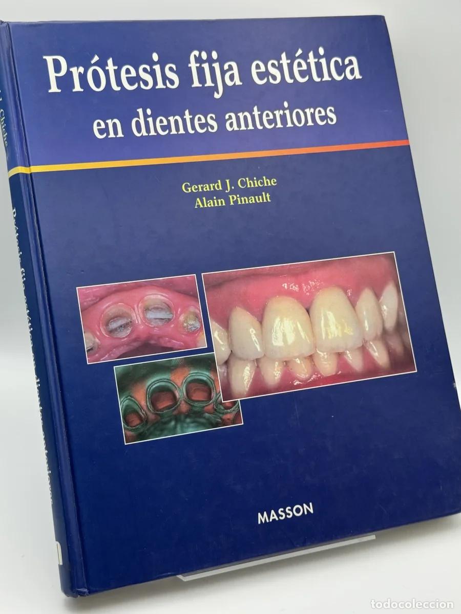 Libros de segunda mano: Protesis Fija Estetica En Dientes Anteriores - Gerard J. Chiche, Alain Pinault