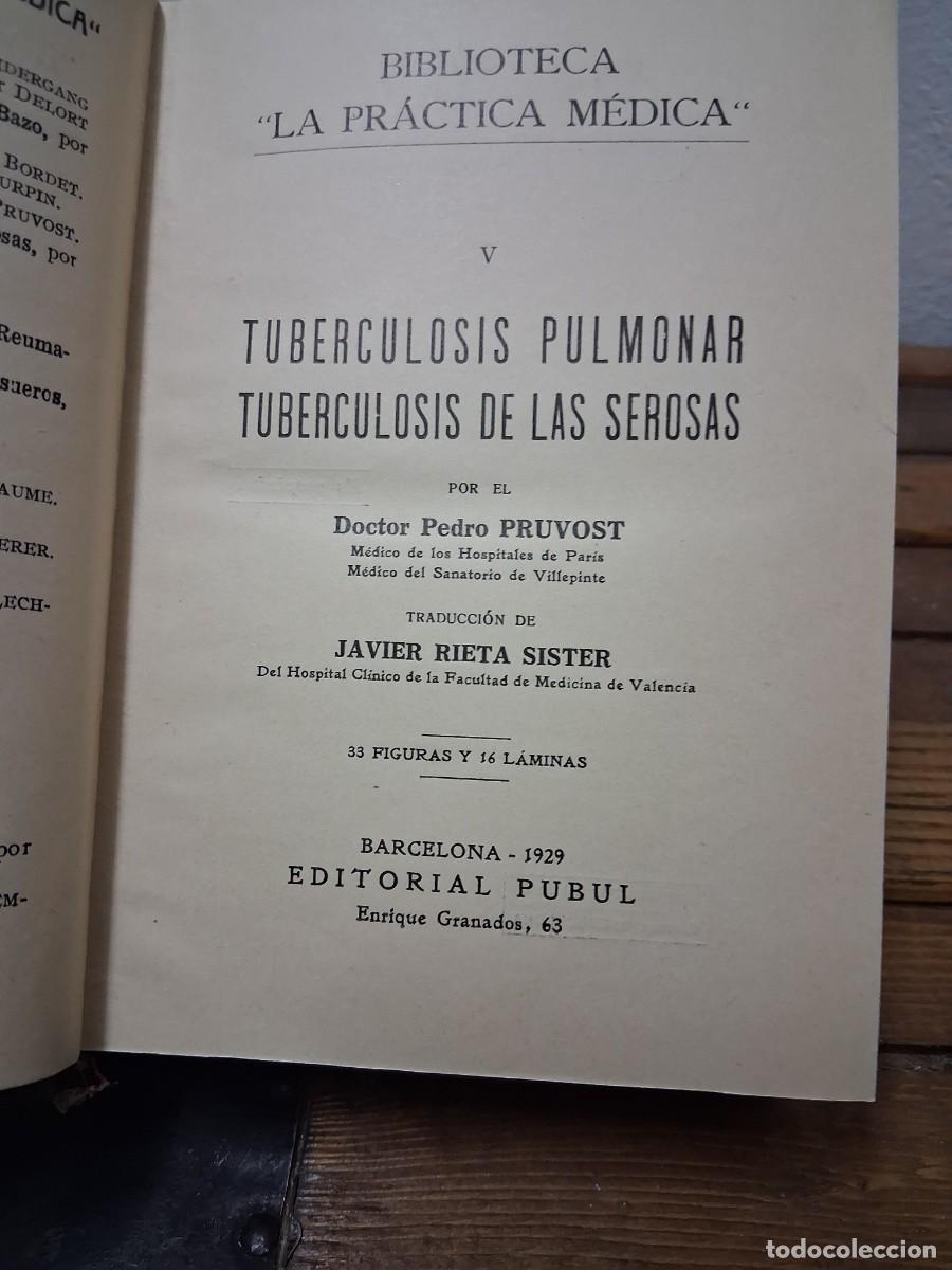 Libros de segunda mano: Libro a&ntilde;o 1929 tomo 5 medico medicina pr&aacute;ctica medica editorial Pubul Tuberculosis Pulmonal serosas