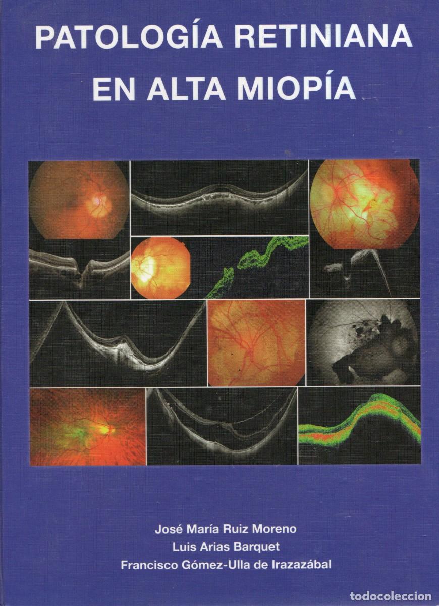 Libros de segunda mano: PATOLOGIA RETINIANA EN ALTA MIOPIA VV.AA. A-MEDI-1220
