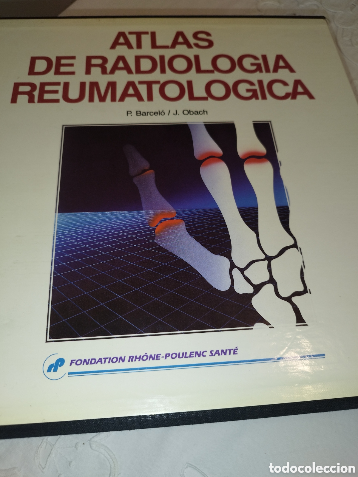 Libros de segunda mano: ATLAS DE RADIOLOGIA REUMATOLOGICA 5 TOMOS .- P. BARCELO / J. OBACH. ED. DOYMA, 1988 MUY ILUSTRADO.