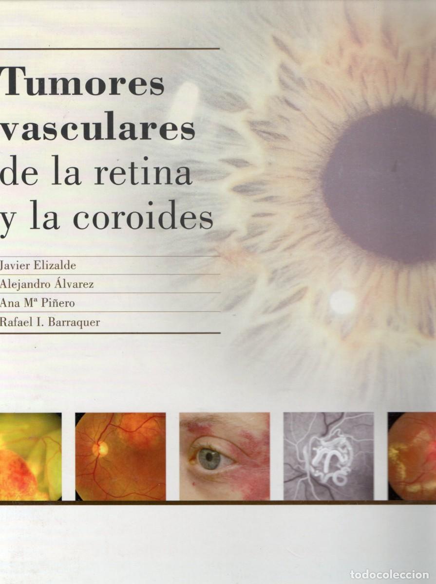 Libros de segunda mano: TUMORES VASCULARES DE LA RETINA Y LA COROIDES. A-MEDI-1223