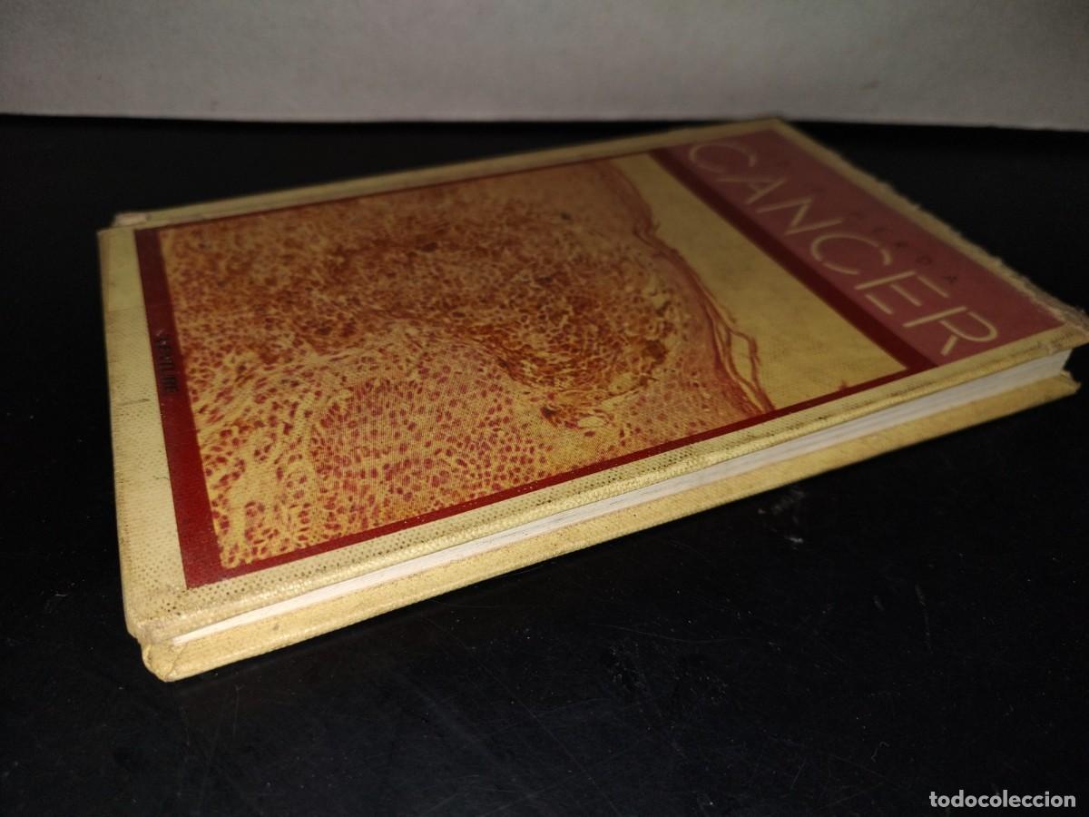 Libros de segunda mano: 218- Cancer - D. J. Herda - Foto 4