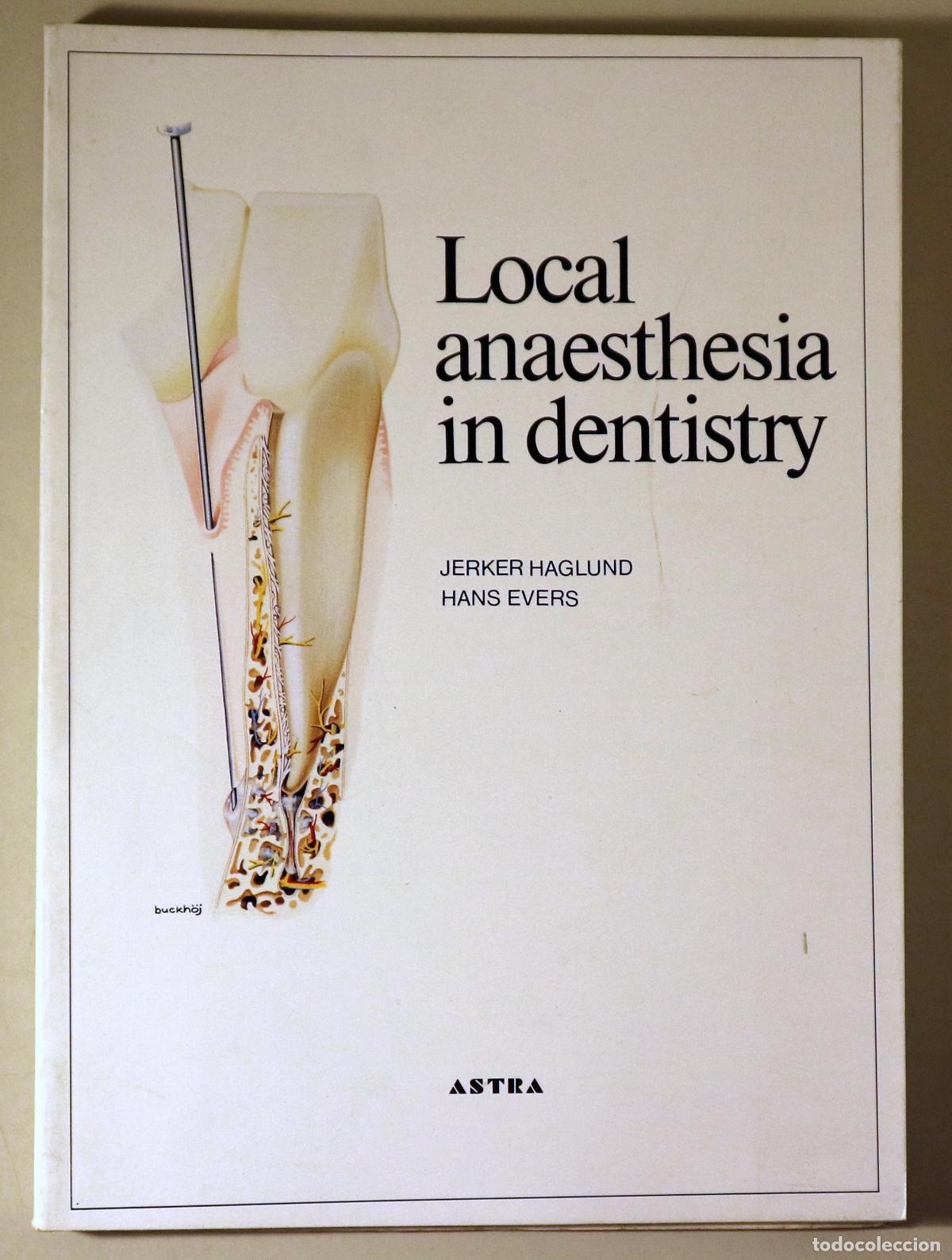 Libri di seconda mano: HAGLUND, Jerker - EVERS, Hans - LOCAL ANAESTHESIA IN DENTISTRY - S&ouml;dert&auml;lje 1988 - Ilustrado