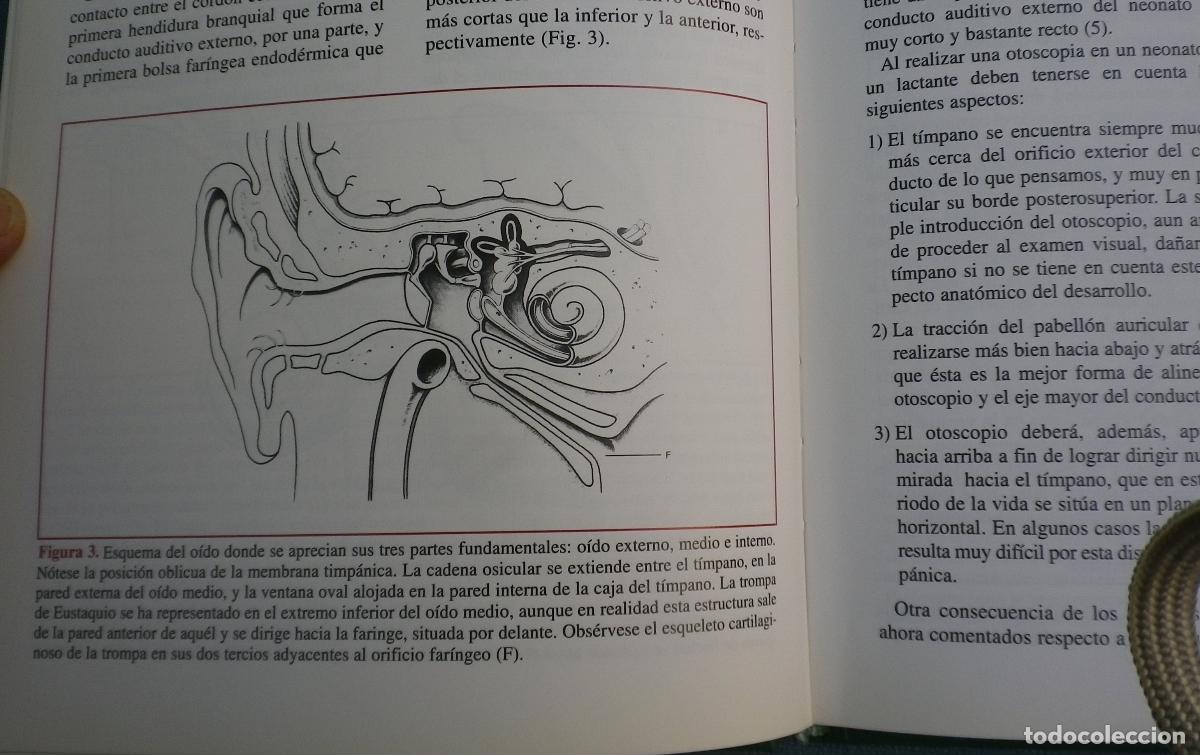 Libros de segunda mano: La Otitis media en la infancia - Foto 2