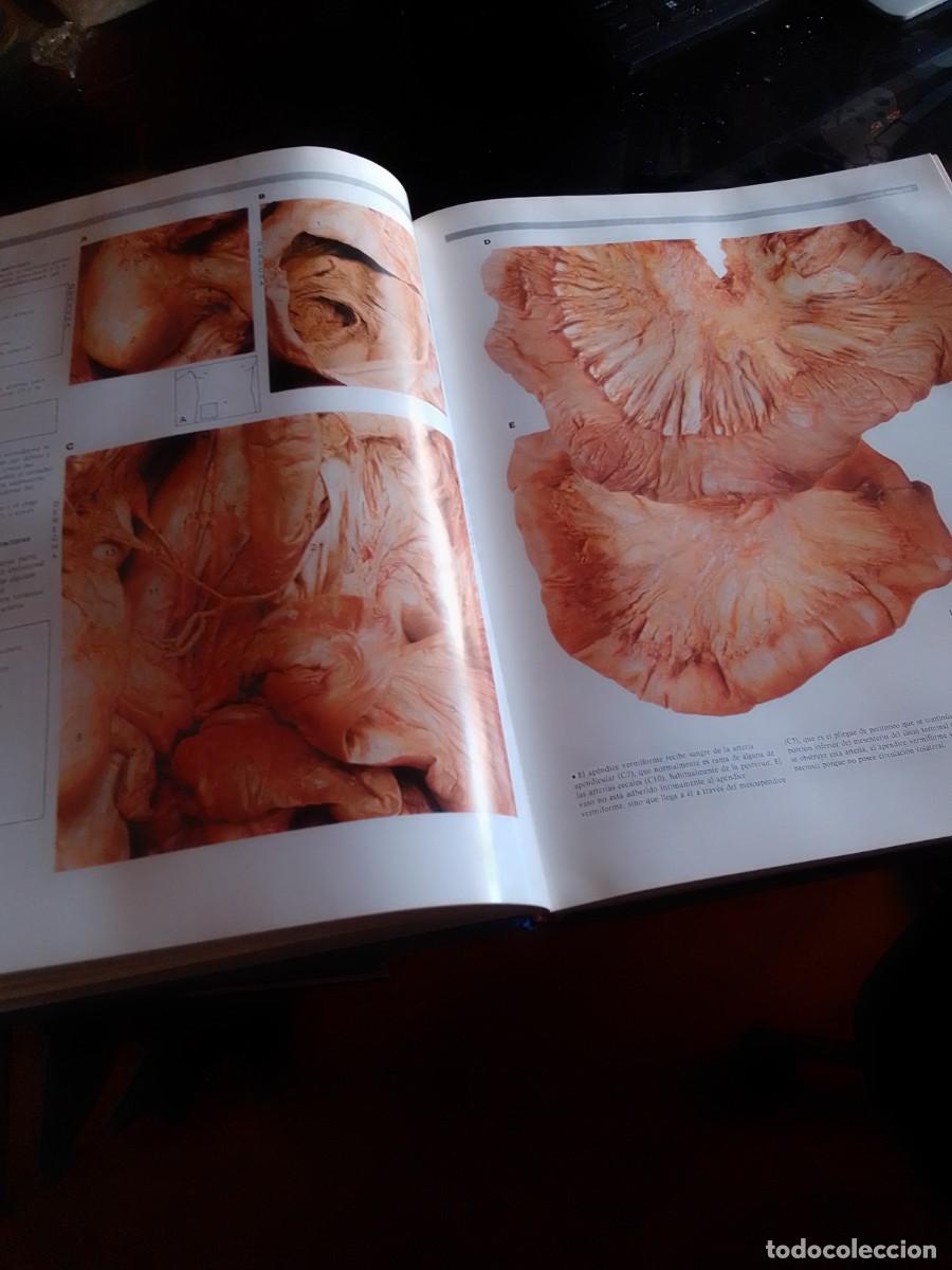 Libros de segunda mano: Atlas de anatom&iacute;a, 2 tomos - Foto 3