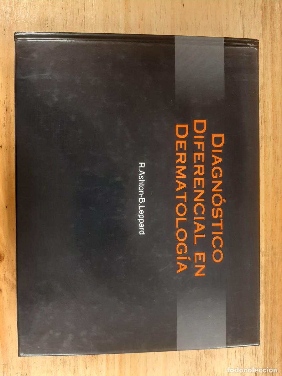 Libros de segunda mano: Diagn&oacute;stico diferencial en dermatolog&iacute;a - R. Ashton y B. Leppard - Iatros -Grass Ediciones, 1994
