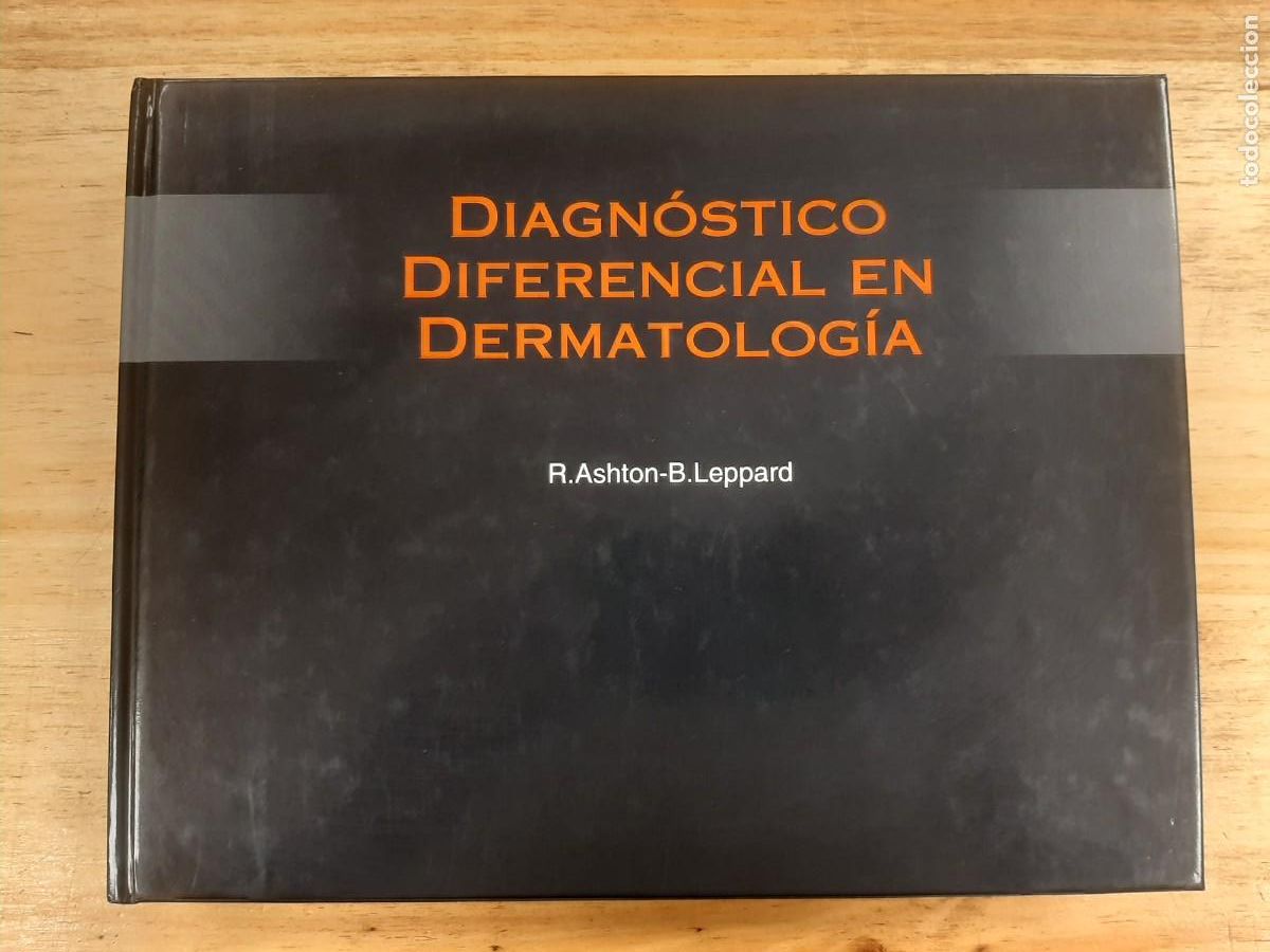 Libri di seconda mano: Diagn&oacute;stico diferencial en dermatolog&iacute;a - R. Ashton y B. Leppard - Iatros -Grass Ediciones, 1994