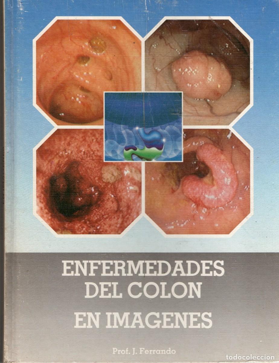 Libros de segunda mano: ENFERMEDADES DEL COLON EN IM&Aacute;GENES. FERRANDO, J. A-MEDI-1257